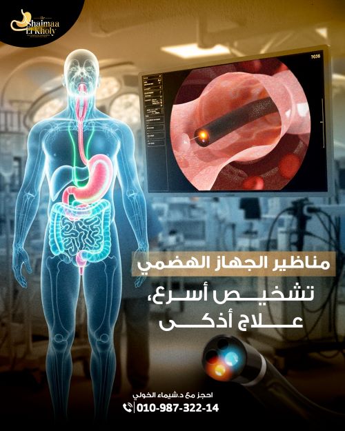 علاج فتق الحجاب الحاجز